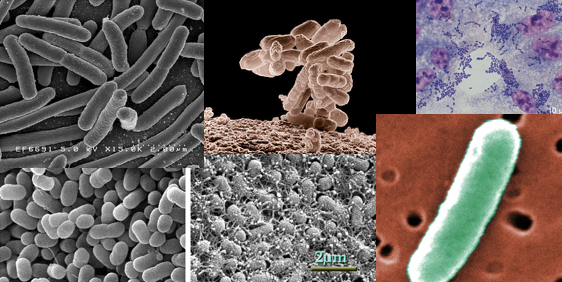 Collage
	      of photos of 6 E. coli strains